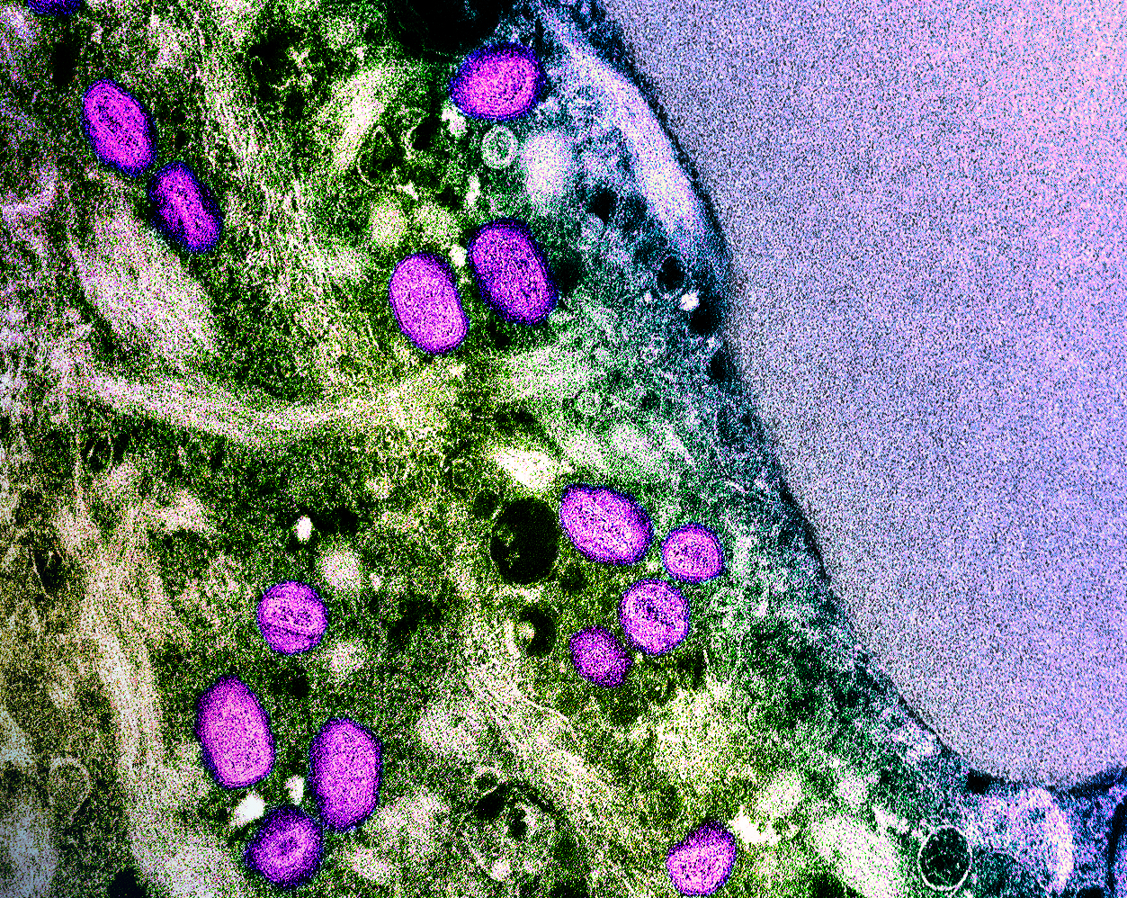 Mpox, again